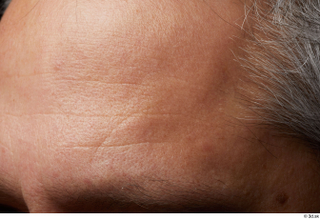  HD Face skin references Lukas Mina eyebrow forehead skin pores skin texture wrinkles 0003.jpg
